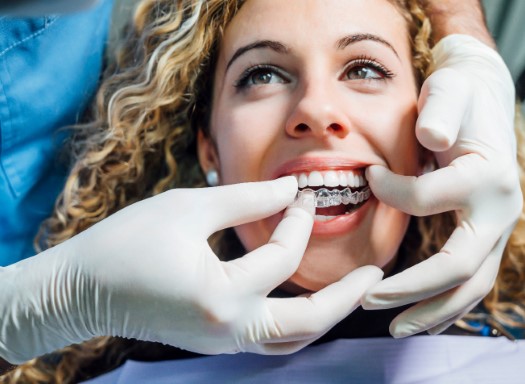 Dentist placing Invisalign aligner on patient's teeth