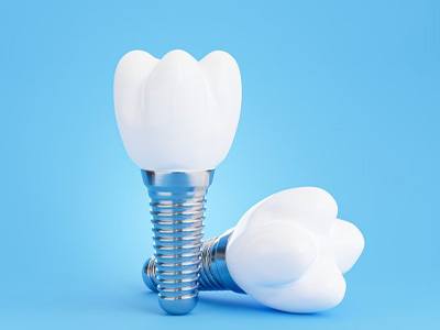 Close up of dental implants on blue background